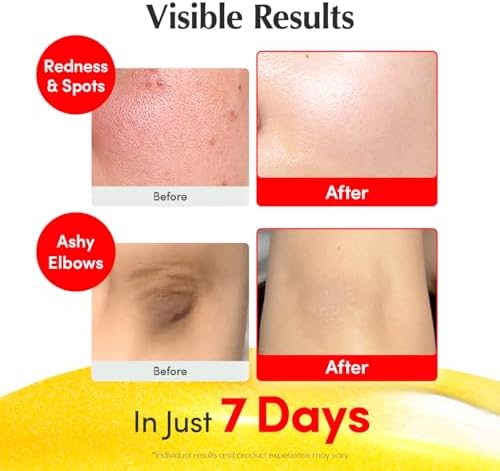 EQQUALBERRY Vitamin Illuminating Serum 30 ml – Vitamin C & Niacinamide Face Serum with Arbutin, Ceramides & Hyaluronic Acid, Hydrating Radiance-Support