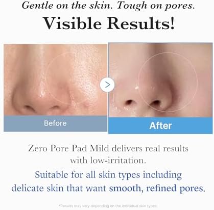 medicube Zero Pore Pads Mild 2.0 - Gentle Calming Toner Pads for Exfoliation, Minimizing Pores, and Blackhead Removal with PHA - Ideal for All Skin Types - Korean Skin Care