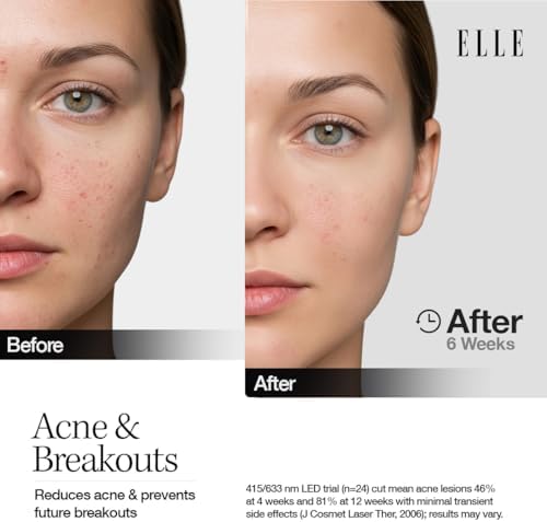 ELLE Radiance Boost Pro LED Face Mask – FDA Approved & Clinically Proven Light Therapy for Glowing, Youthful Skin | Red, Blue & Infrared Light | Boosts Collagen, Reduce Wrinkles, Breakouts & Blemishes