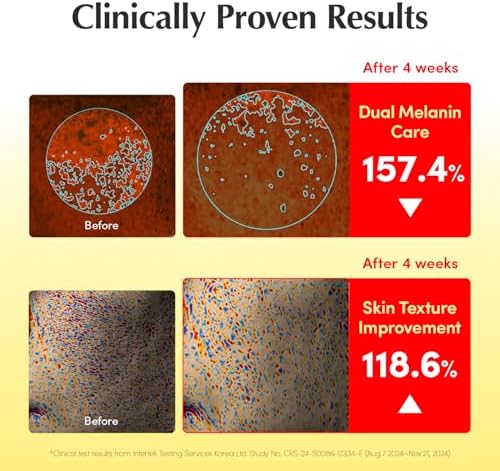 EQQUALBERRY Vitamin Illuminating Serum 30 ml – Vitamin C & Niacinamide Face Serum with Arbutin, Ceramides & Hyaluronic Acid, Hydrating Radiance-Support